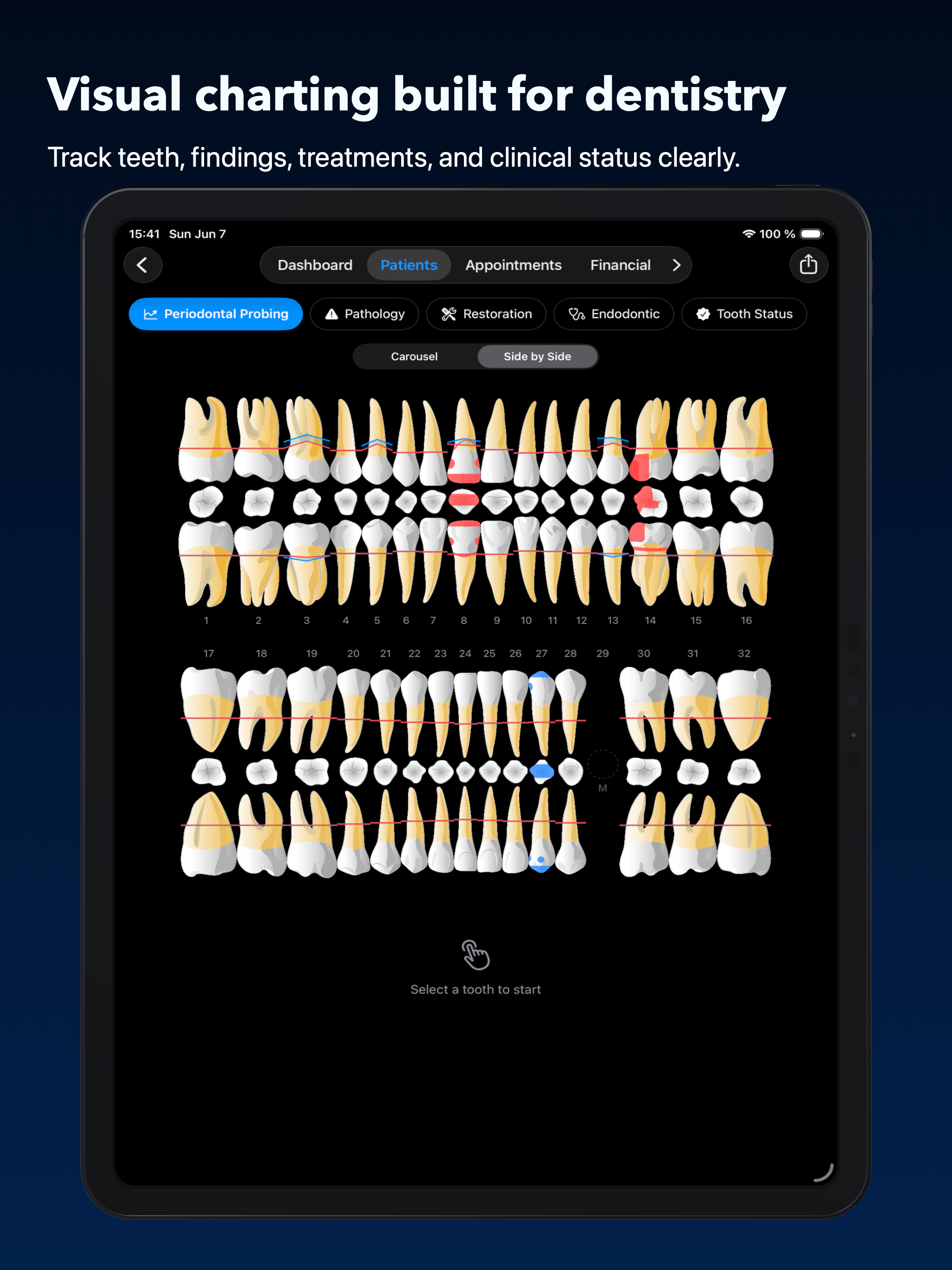 Visual dental chart on iPad