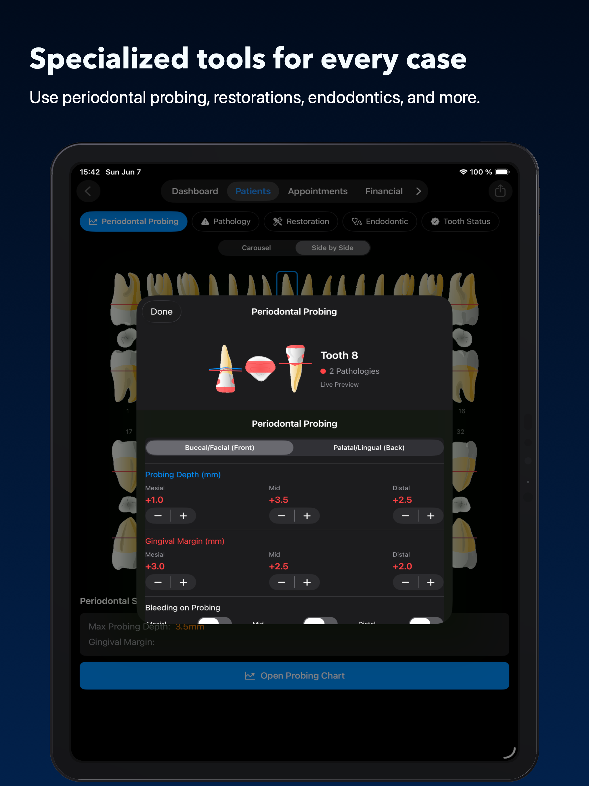 Periodontal probing on iPad