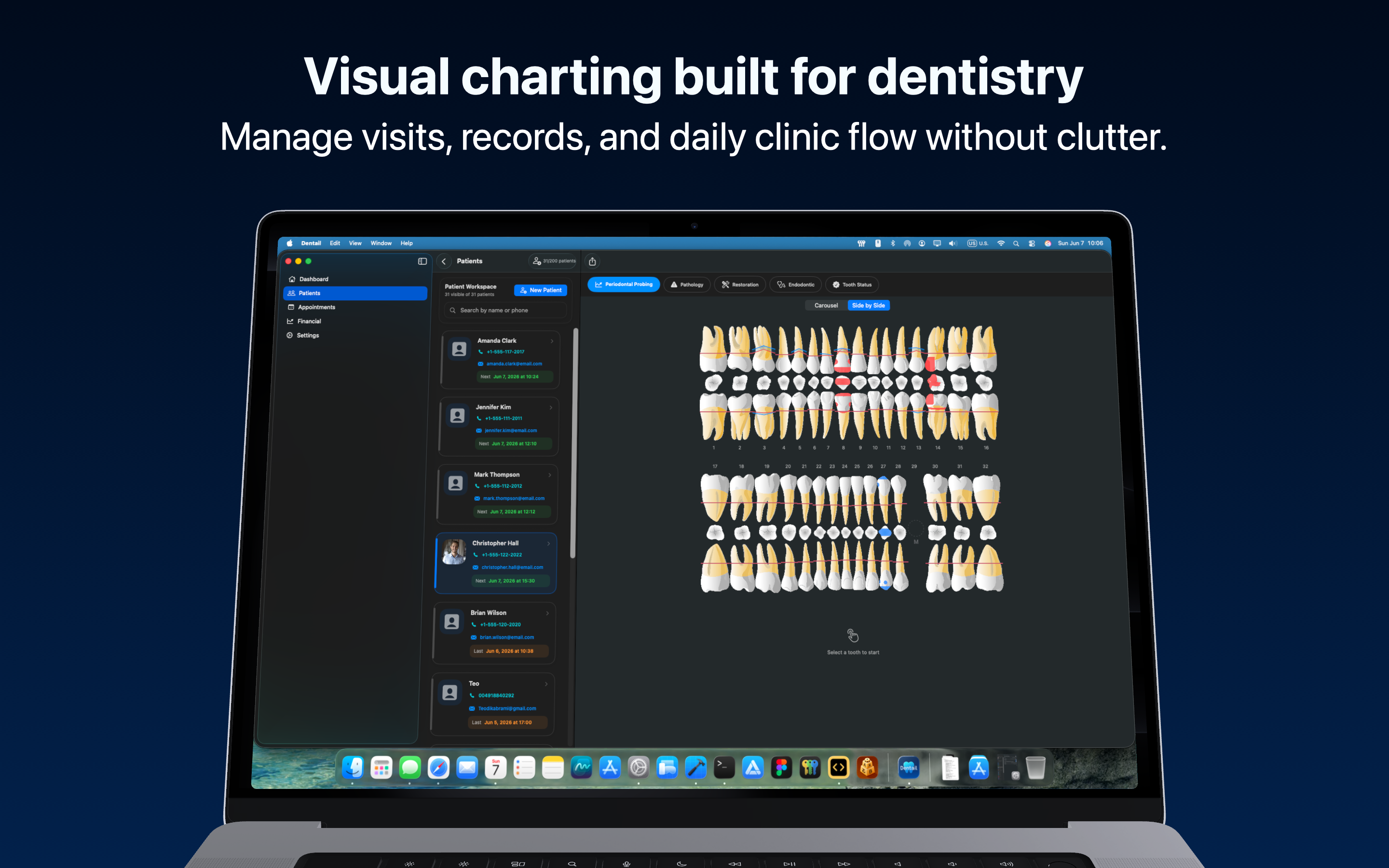 Dentail 2.0 on Mac